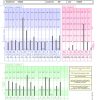 Trace Elements Hair Test - HTMA Hair Analysis Testing can help optimize your thyroid, adrenal, and sex hormone balance with mineral balancing.