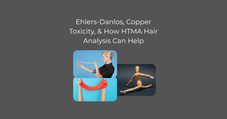 Ehlers Danlos EDS Hyper mobility